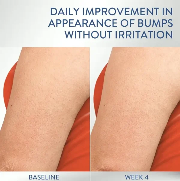 CETAPHIL Moisturizer for Rough Surface - Unscented Treatment