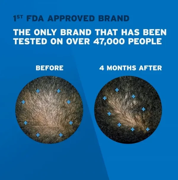 Men's Rogaine Five Percent Hair Regrowth Treatment, 3 Month Supply