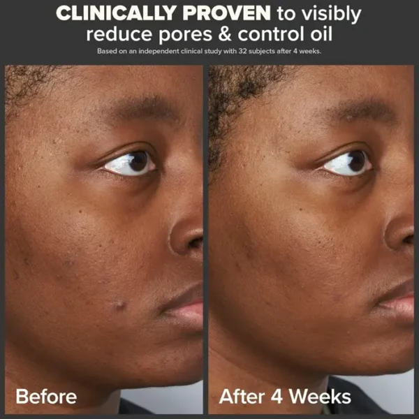 Paula's Choice 2% Beta Hydroxy Acid Skin Exfoliator for Wrinkles