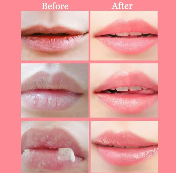 Bee Lip Set, Nourishing Lip Care