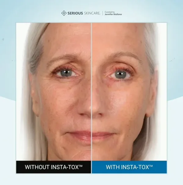 Instant Wrinkle Smoothing Gel - Firms Skin