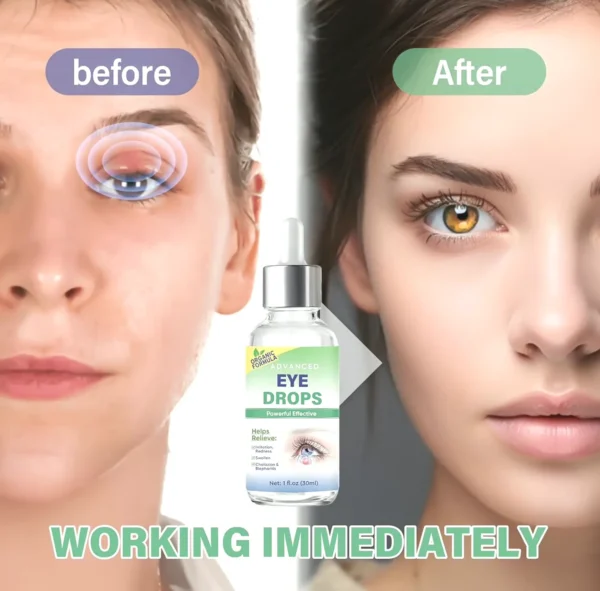 Sty Ocular Care, Drops for Styes and Chalazion, 30ml