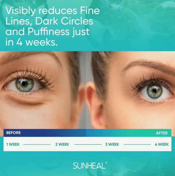 Vitamin A Eye Cream for Visible Circles & Swelling