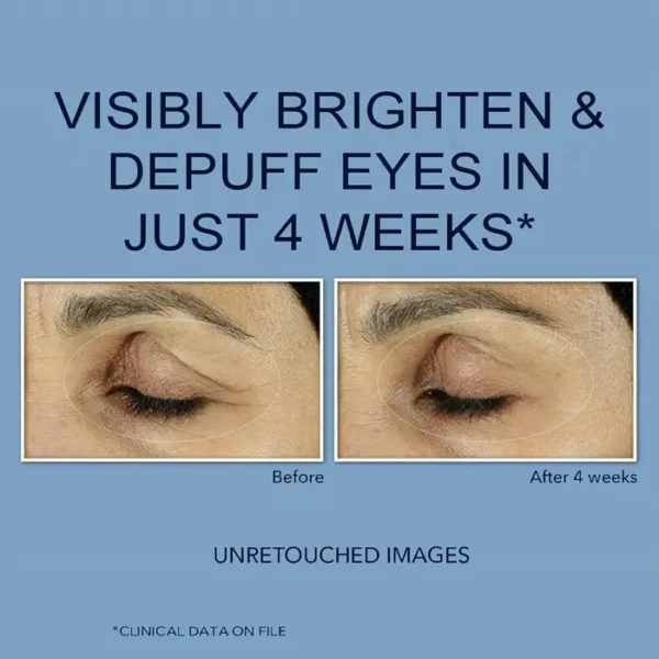 RoC Retinoid Under-Eye Cream for Eye Bags and Swelling, 15ml