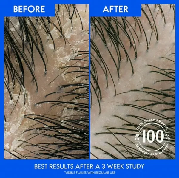 Head & Shoulders Two-in-One Shampoo Set