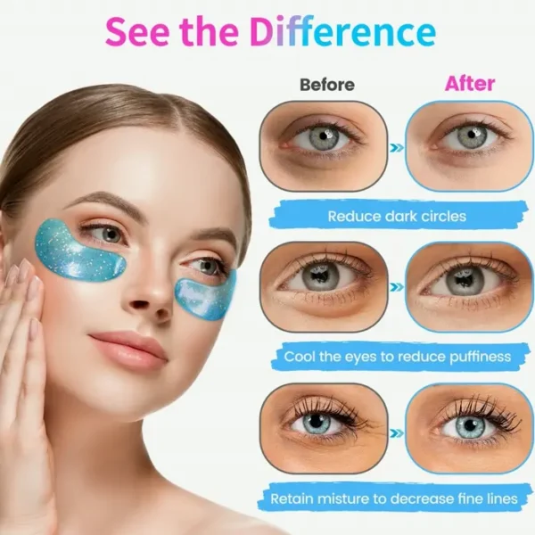 Under Eye Patches (32 Sets) - Collagen-Loaded, Anti-Swelling & Dark Circle Treatment