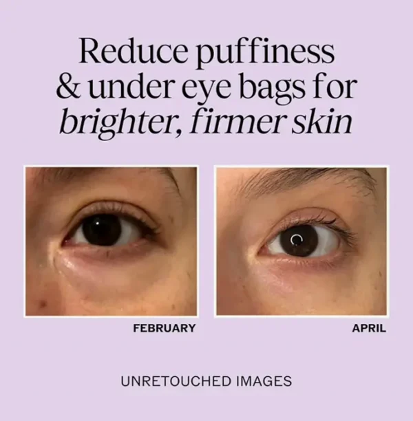 Organic Eye Cream for Dark Circles and Swelling