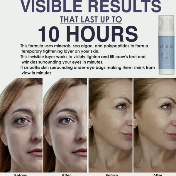 Quick Eye Lift Treatment - Visible Results for Wrinkle Reduction