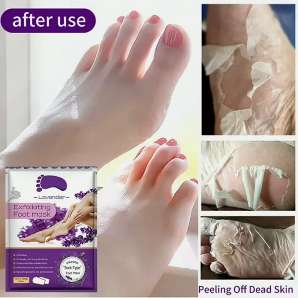 Feet Peel Wraps Pack - Softens Dry Skin