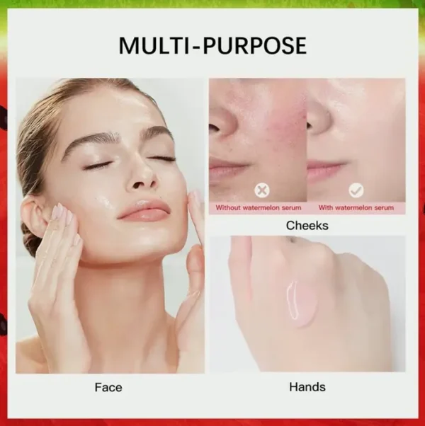 Melon Niacinamide Face Serum (1PCS)