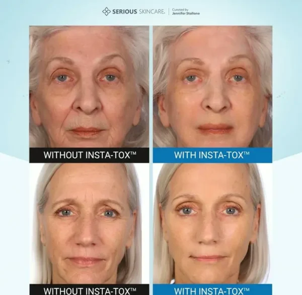 Instant Wrinkle Smoothing Gel - Firms Skin